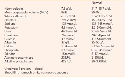 85-Year-Old Woman With Loss Of Appetite